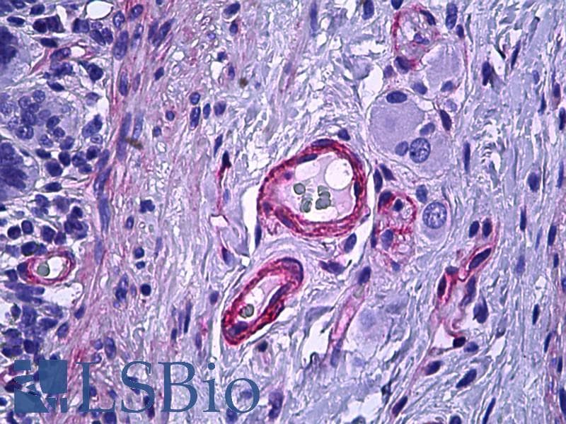 IHC-plus™ ETK / BMX Antibody (aa11-60)