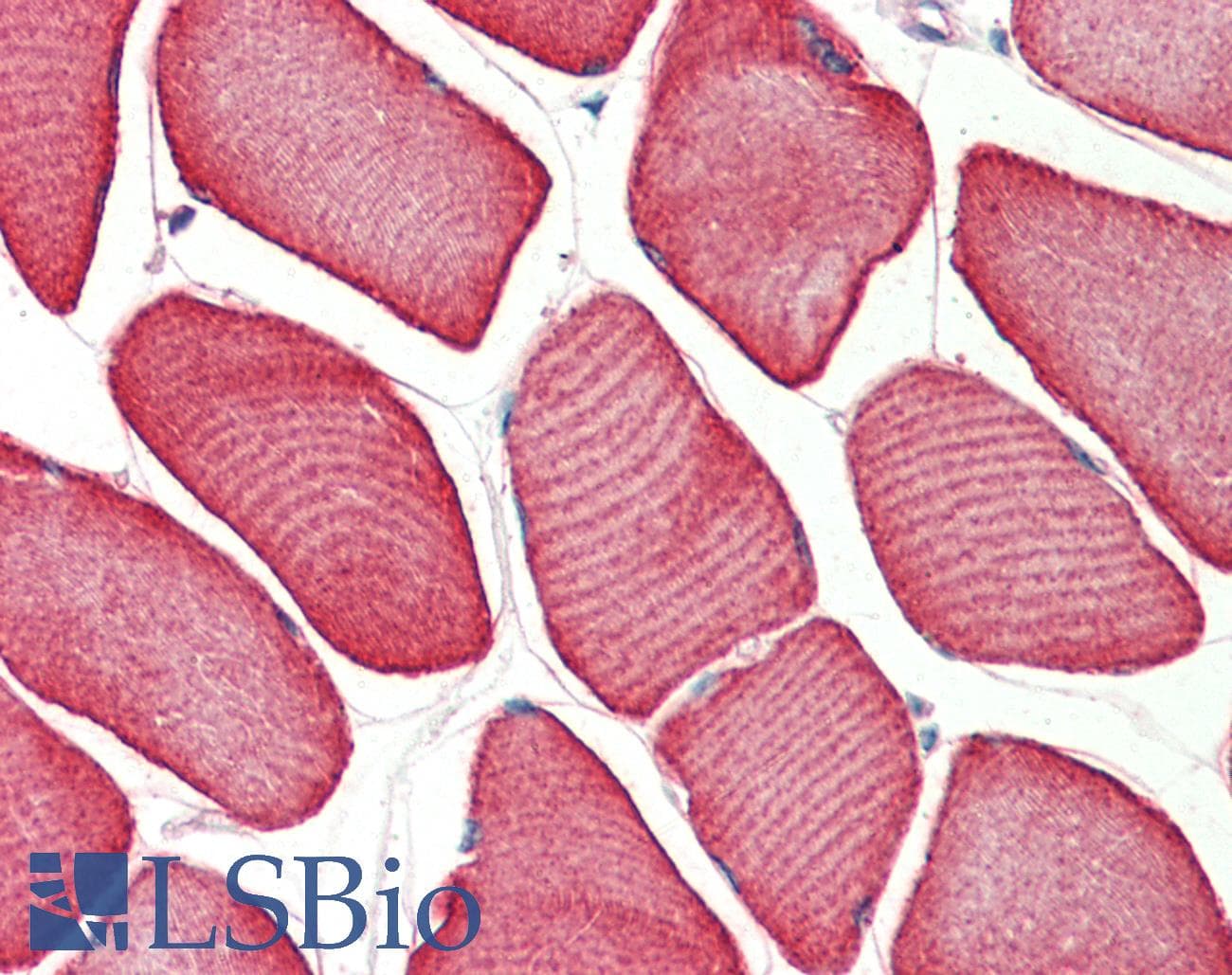 IHC-plus™ TNNT1 / TNT Antibody (aa205-218)