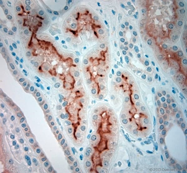 SLC5A8 / AIT Antibody (aa560-610)