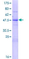 Human SCC4 / MAU2 Protein (Recombinant GST)