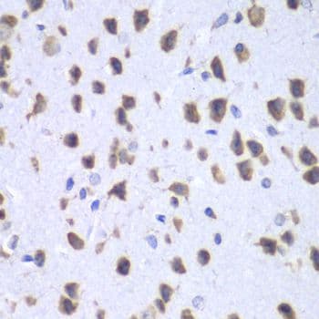 RENT1 / UPF1 Antibody