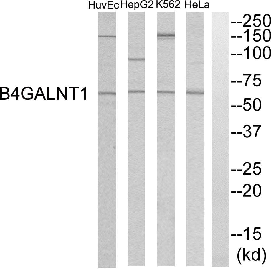 B4GALNT1 / GM2/GD2 Synthase Antibody