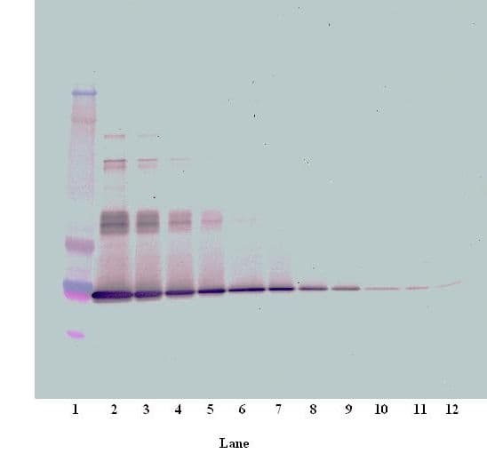 IL6 / Interleukin 6 Antibody