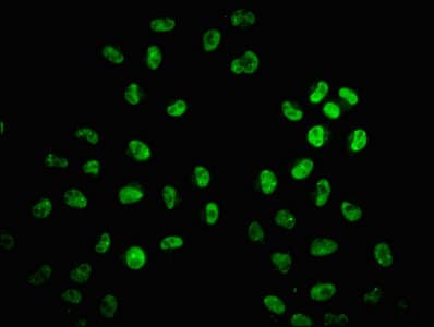 HIST1H2AI Antibody