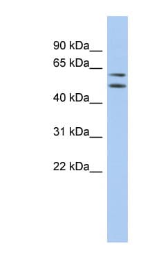 ABHD15 Antibody (aa107-156)