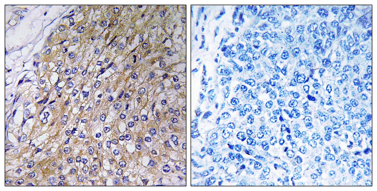 Polyclonal Rabbit anti-Human GOLT1A Antibody (aa40-89, IHC)