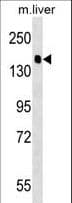 Polyclonal Rabbit anti-Human PPFIA2 Antibody (aa571-599, WB)
