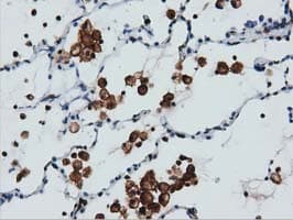 Monoclonal Mouse anti-Human ARHGAP25 Antibody (clone OTI12E6, IHC, IF, WB)