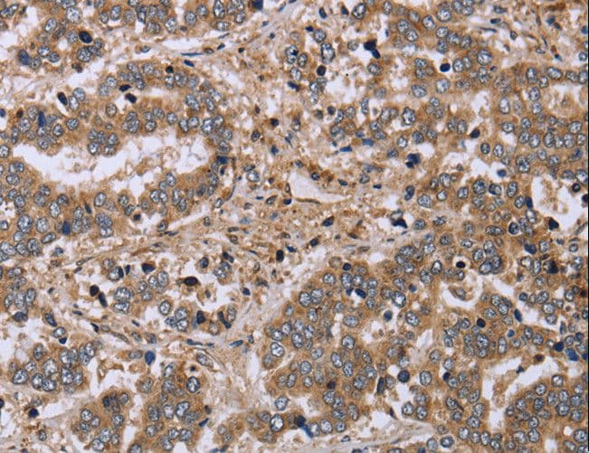 SLIM / FHL1 Antibody