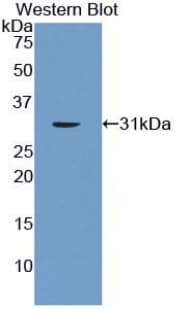 LIG1 / DNA Ligase 1 Antibody (aa739-995)