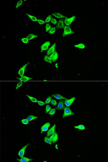Polyclonal Rabbit anti-Human CD55 Antibody (IHC, IF, WB)