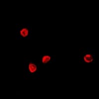 TCF4 Antibody