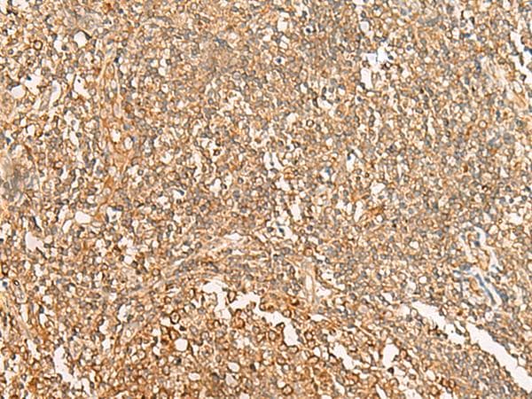 Polyclonal Rabbit anti-Human NARS Antibody (IHC)