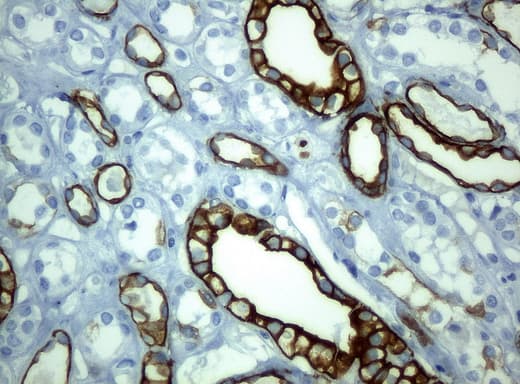 KRT19 / CK19 / Cytokeratin 19 Antibody (aa240-390, clone UMAB2)