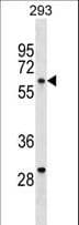 YES1 / c-Yes Antibody (aa1-30)