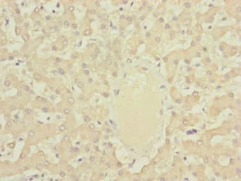 Polyclonal Rabbit anti-Human DYNC2LI1 / D2LIC Antibody (IHC, WB)