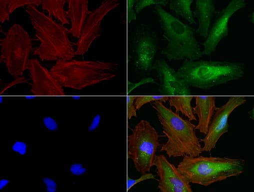 Monoclonal Mouse anti-Human SQSTM1 Antibody (clone UMAB13, IHC, IF, WB)