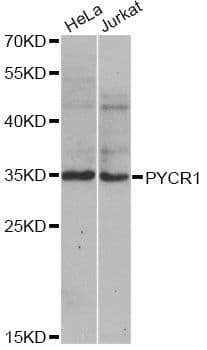 Polyclonal Rabbit anti-Human PYCR1 Antibody (IHC, WB)