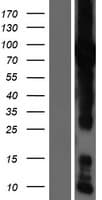 GFPT1 / GFAT Protein (Over-Expression Lysate Myc-DDK (Flag))