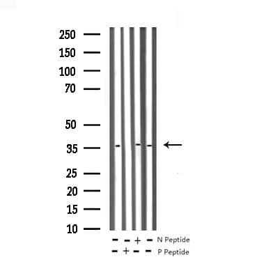 Polyclonal Rabbit anti-Human JUN / c-Jun Antibody (phospho-Tyr170, IHC, WB)