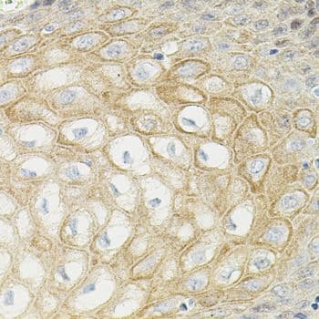 ATF6 Antibody