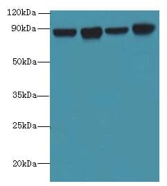 Polyclonal Rabbit anti-Human DDX50 Antibody (IHC, WB)