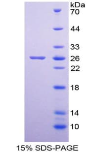 Human NF90 / ILF3 Protein (Recombinant His-T7)