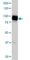 IHC-plus™ SLMAP / SLAP Antibody (clone 2A7)