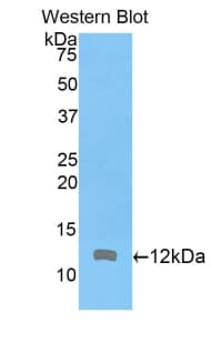 ARPC4 Antibody (aa79-164, PE)