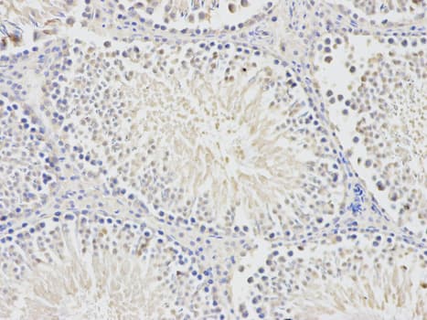 BTC / Betacellulin Antibody