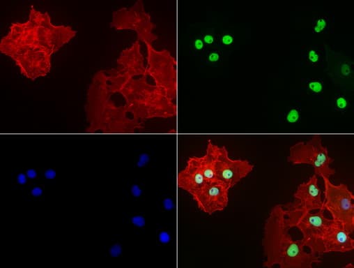 TP53 / p53 Antibody (clone UMAB62, Carrier-free)