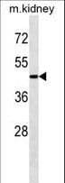 ATG4A Antibody (aa363-392)
