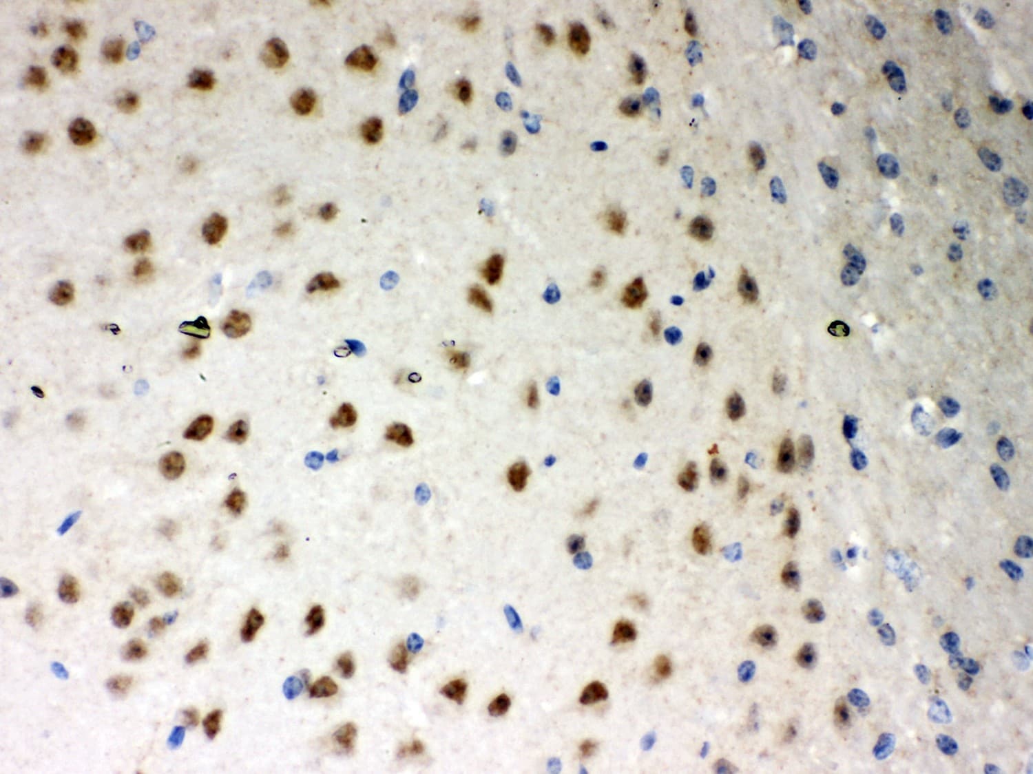 PRKCI / PKC Iota Antibody (aa21-214)