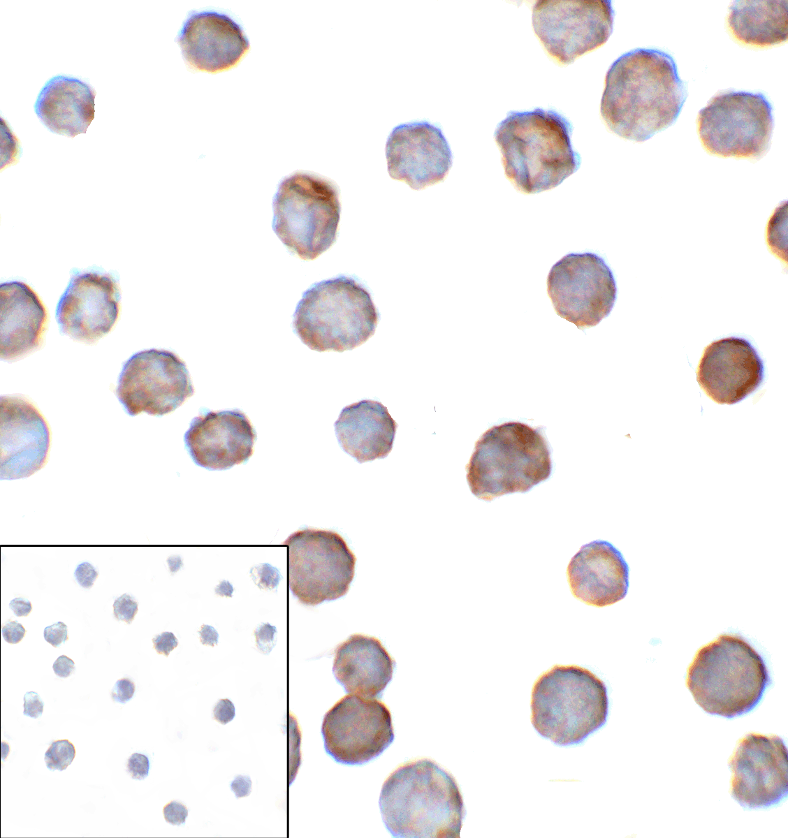 CD276 / B7-H3 Antibody (clone 2H5)