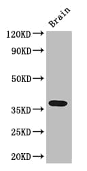 ADORA2B/Adenosine A2B Receptor Antibody