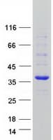 Human FAM84A Protein (Recombinant Myc-DDK (Flag))