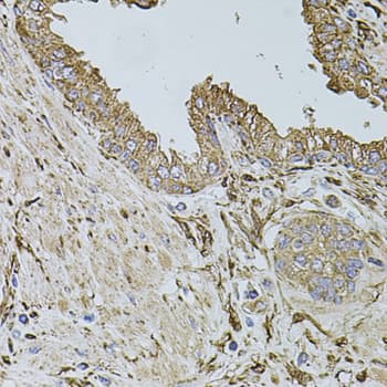 ALDH1A1 / ALDH1 Antibody