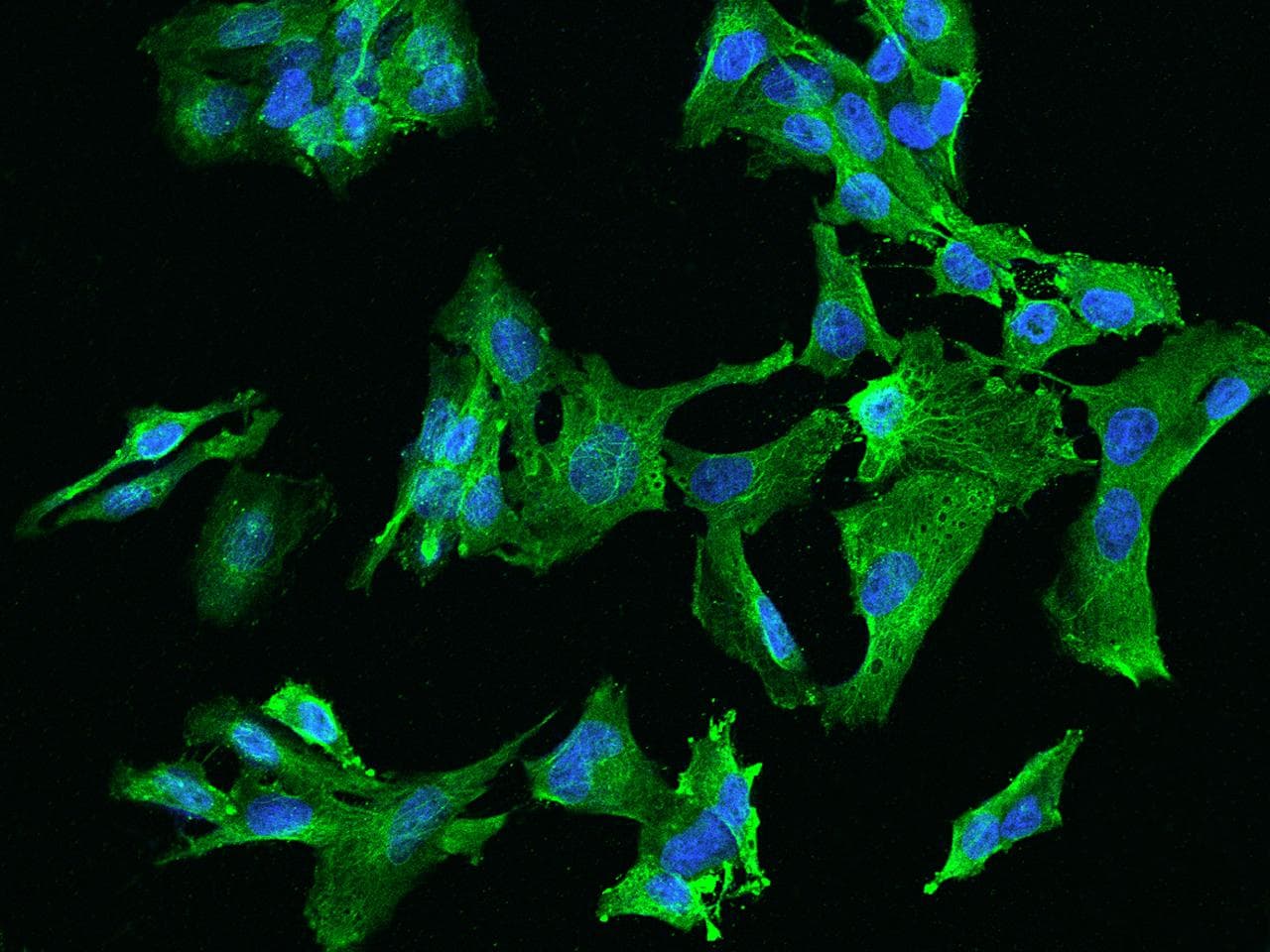 CCDC40 Antibody