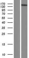 RTEL1 Protein (Over-Expression Lysate Myc-DDK (Flag))