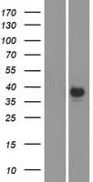 CA6 / Carbonic Anhydrase 6 Protein (Over-Expression Lysate Myc-DDK (Flag))