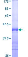 Human SIPA1 Protein (Recombinant GST, N-terminus)