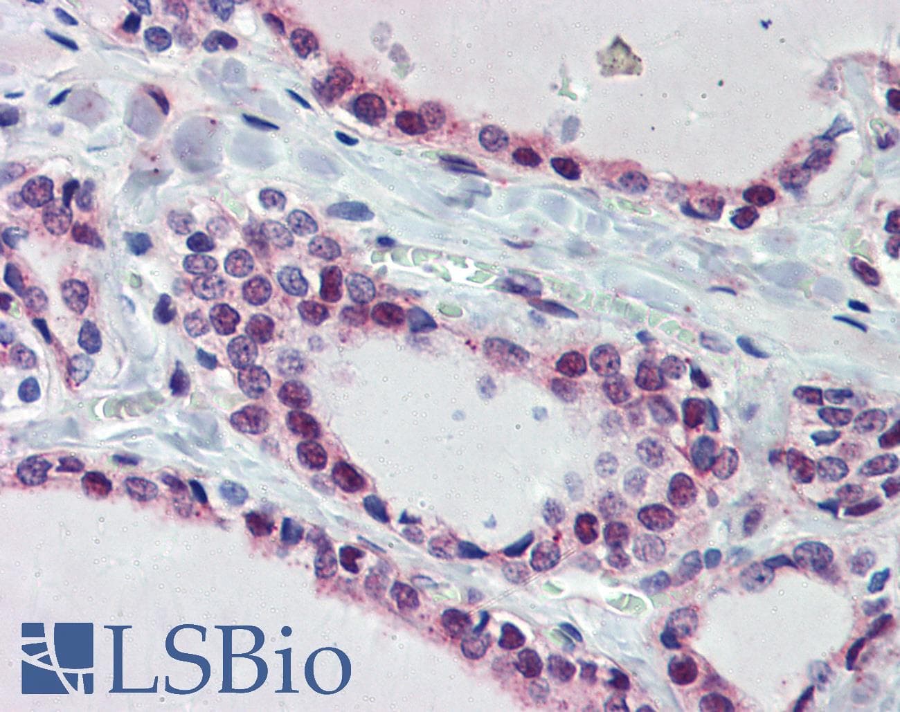 Polyclonal Rabbit anti-Human FUBP3 Antibody (aa503-552, IHC, WB)