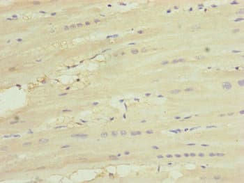 UQCC2 / MNF1 Antibody