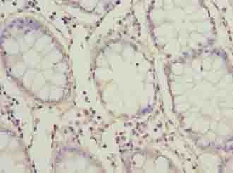 ZNF767 Antibody