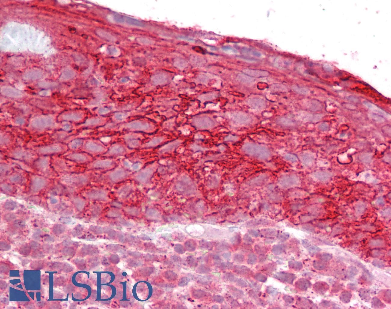 IHC-plus™ Polyclonal Goat anti-Human TROP2 / TACSTD2 Antibody (aa195-208, IHC, WB)