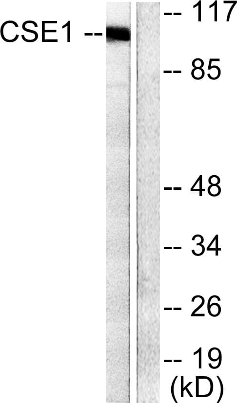 IHC-plus™ CSE1L Antibody (aa1-50)