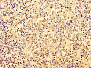 Polyclonal Rabbit anti-Human EBF2 Antibody (IHC)