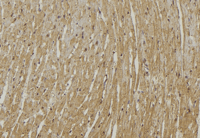Polyclonal Rabbit anti-Human LMOD3 Antibody (IHC, WB)