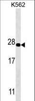 IHC-plus™ PSMA5 Antibody (clone 426CT8.5.1)