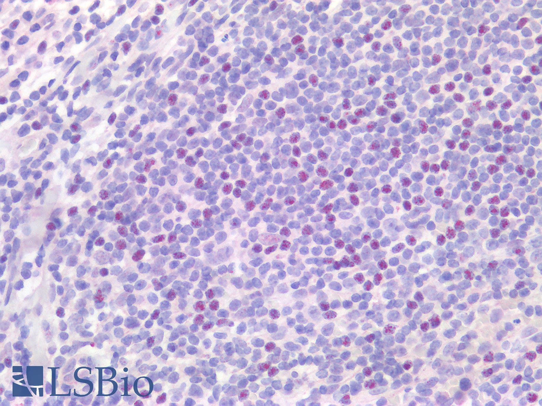 IHC-plus™ IL17A Antibody